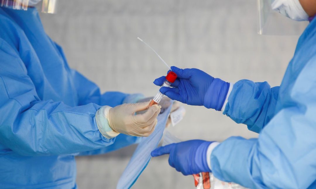 Nova Friburgo recebe testes rápidos para diagnóstico da COVID-19 em profissionais de saúde