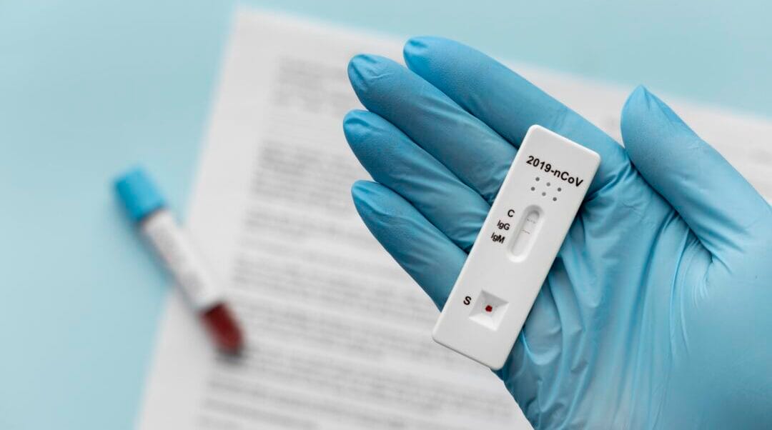 Nova Friburgo mantém porcentagem de negatividade maior em relação aos testes de Covid-19