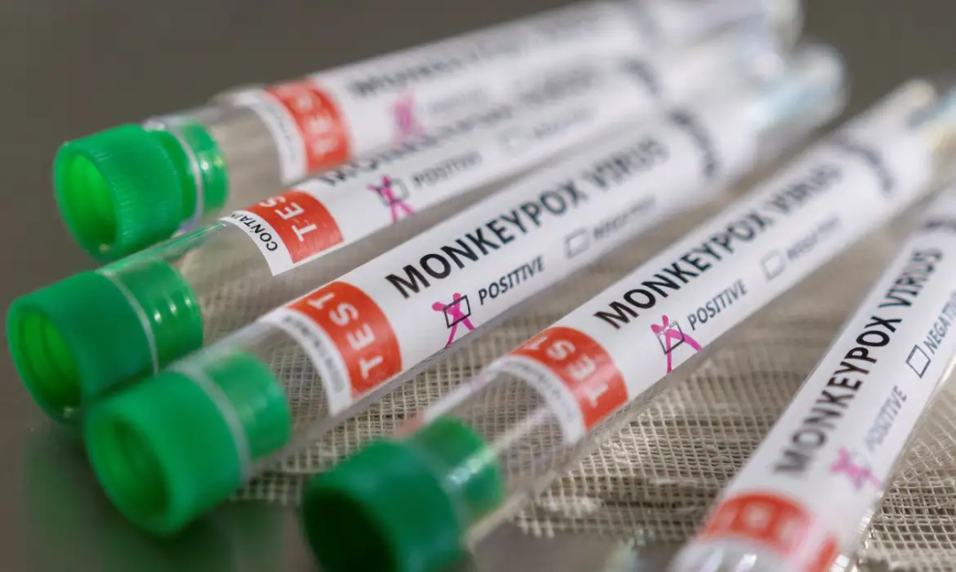 Alerta de saúde: Casos de Mpox no Brasil já superam total de 2023; Veja os detalhes