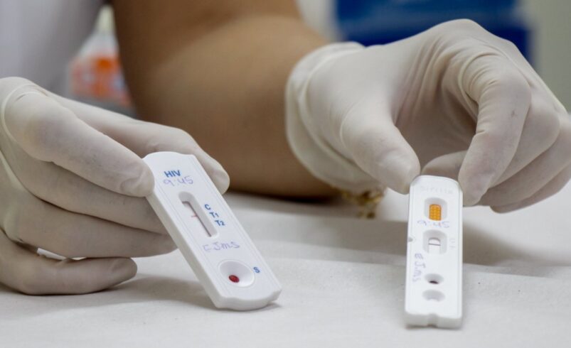 Testes rápidos HIV