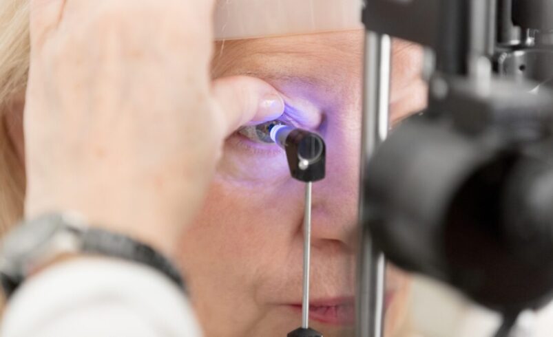 GLAUCOMA